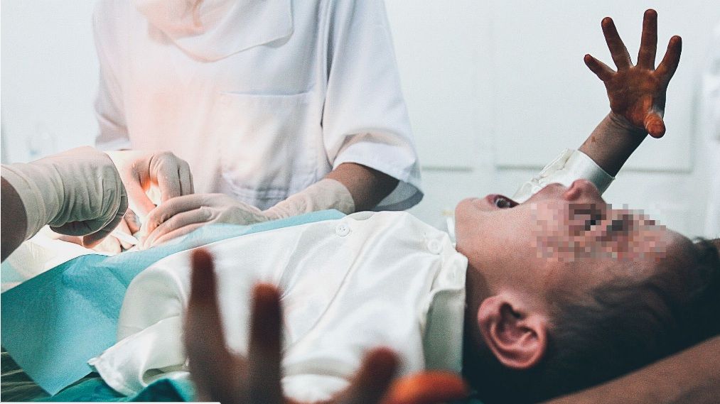 مأساة.. طبيب بالرشيدية يتسبب في بتر العضو الذكري لطفل