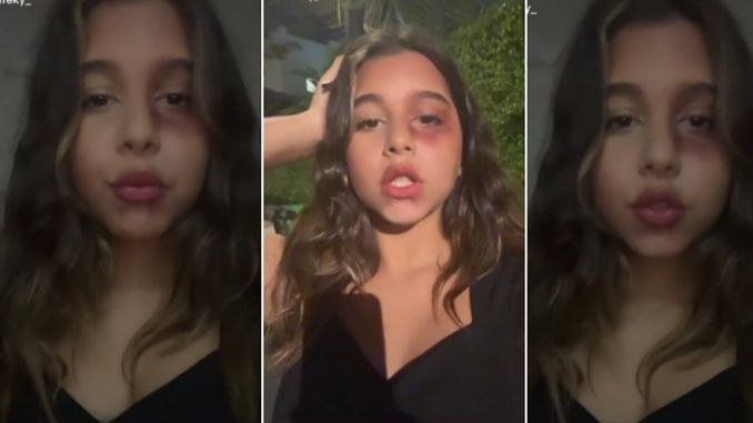 ابنة شيرين الصغرى تكشف حقيقة تعرضها للضرب