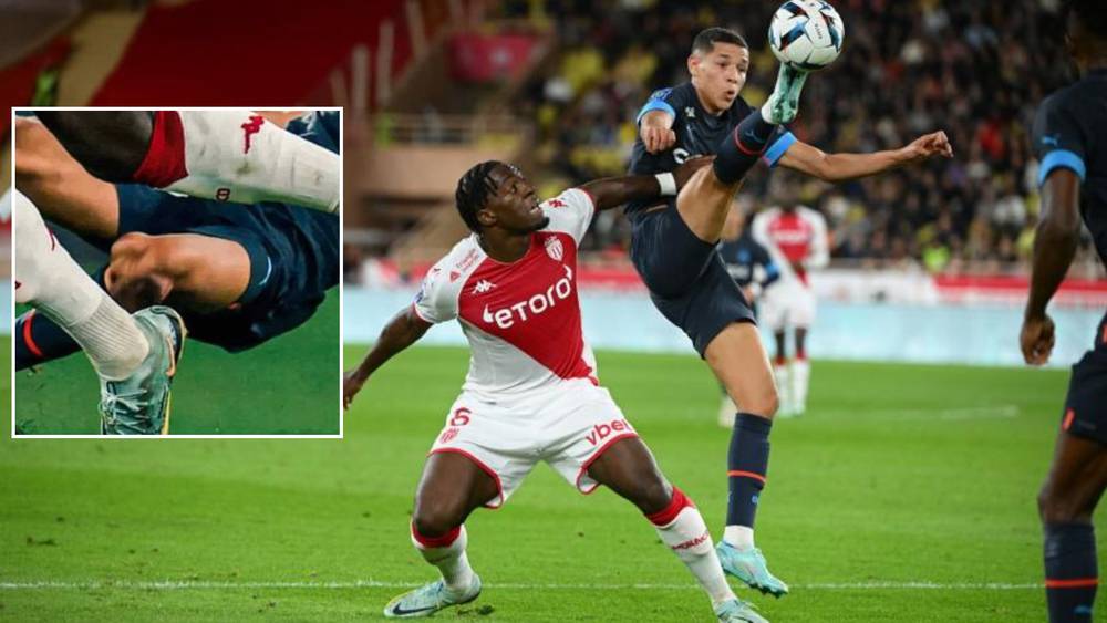 لاعب موناكو أليكس ديساسي يصرح بعد إصابة حارث التحكيم كان لصالح مارسيليا ونحن لا نرقص إنما نلعب كرة القدم إنها رياضة الاحتكاك والنزالات الثنائية